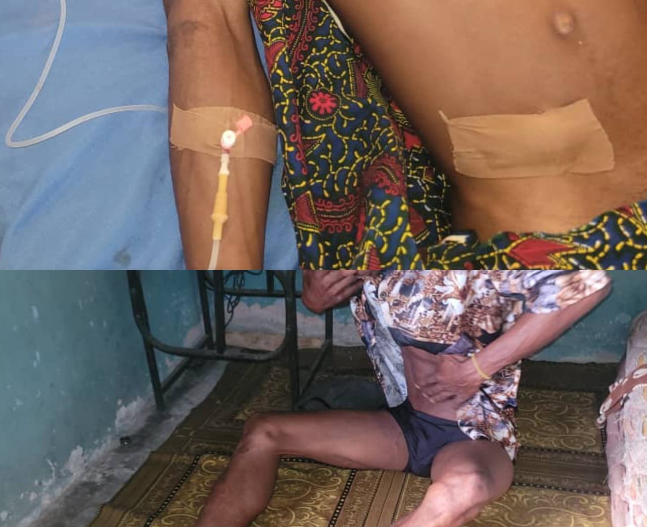 Oden Ewa Foundation intervenes in Master Stephen Bassey's Medical condition