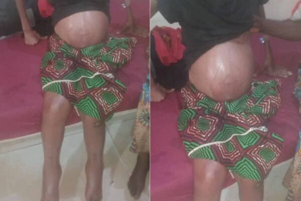 Saving a Life: Oden Ewa Foundation’s Swift Humanitarian Intervention in the Case of Miss Peace