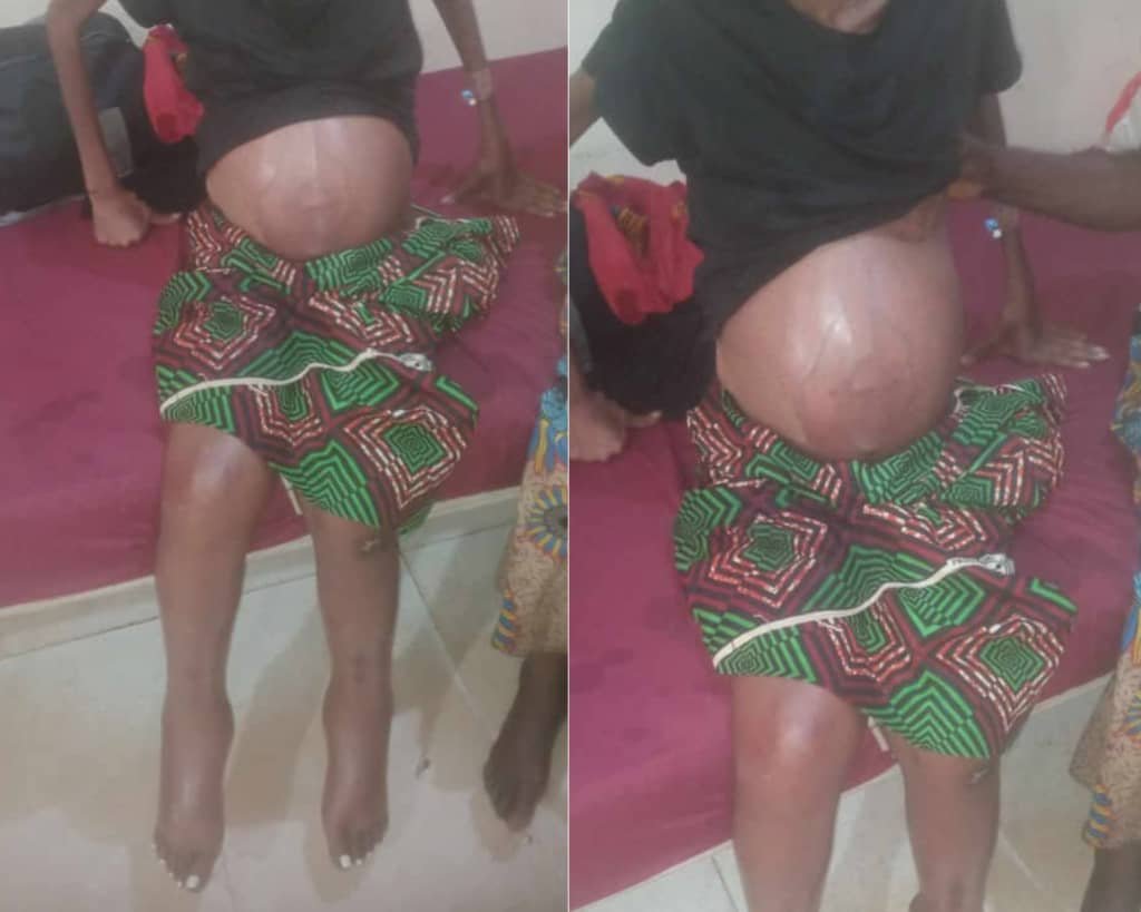 Saving a Life: Oden Ewa Foundation’s Swift Humanitarian Intervention in the Case of Miss Peace