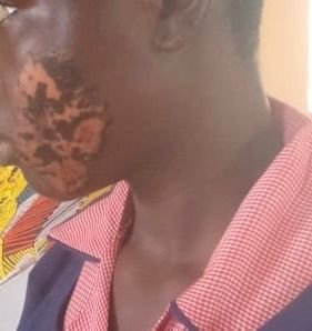 Police arrest woman for allegedly inflicting injuries on her 17-year-old maid