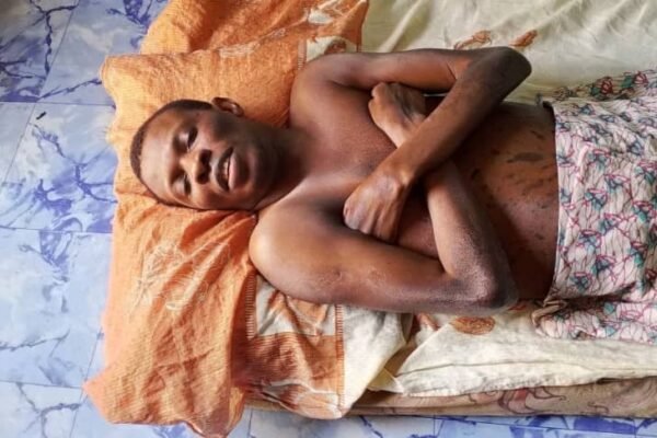 Paralysed for 23 years, Cross River man seeks government intervention