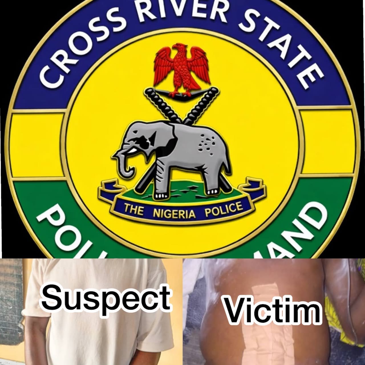 Theater assistant arrested for carrying out surgery on patient in Cross River